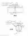 Fig. 02 - Mercury-in-pipe assessment tool and method of using the same