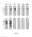 Fig. 04 - Method of Diagnosing Bacterial Infections Using Bacterial Glycoproteins