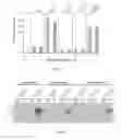 Fig. 05 - Method of Diagnosing Bacterial Infections Using Bacterial Glycoproteins