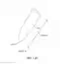 Fig. 30 - Conformable therapeutic shield for vision and pain