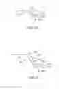 Fig. 42 - Conformable therapeutic shield for vision and pain