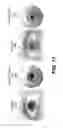 Fig. 12 - Methods and systems of generating a parametric eye model