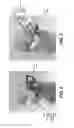 Fig. 07 - Surgeon head-mounted display apparatuses