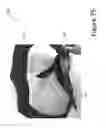 Fig. 76 - Extender belts for pants and trousers
