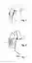 Fig. 02 - Personal head and neck cooling cap