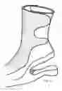 Fig. 06 - High Heel Shoe or Boot Ankle Support