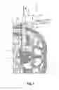 Fig. 02 - Surgical access system and related methods