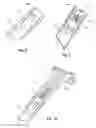 Fig. 09 - Surgical access system and related methods