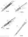 Fig. 30 - Surgical access system and related methods