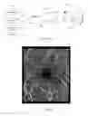 Fig. 02 - Acquisition and analysis techniques for improved outcomes in optical coherence tomography angiography
