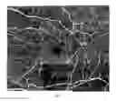 Fig. 04 - Acquisition and analysis techniques for improved outcomes in optical coherence tomography angiography