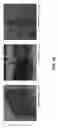 Fig. 48 - Epidermal devices for analysis of temperature and thermal transport characteristics