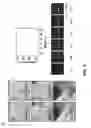 Fig. 64 - Epidermal devices for analysis of temperature and thermal transport characteristics
