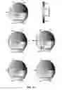 Fig. 68 - Epidermal devices for analysis of temperature and thermal transport characteristics
