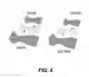 Fig. 05 - MOTOR-ACTIVATED MULTI-FUNCTIONAL WRIST ORTHOTIC