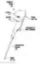 Fig. 01 - Oximetry device with wireless extension