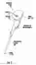Fig. 02 - Oximetry device with wireless extension