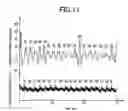 Fig. 07 - Heartbeat-signal detecting device