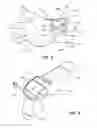 Fig. 02 - Inflatable radial artery compression device