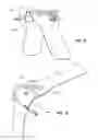 Fig. 07 - Inflatable radial artery compression device