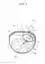 Fig. 07 - HEMOSTATIC DEVICE