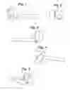 Fig. 02 - SHOULDER ARTHROPLASTY INSTRUMENTATION