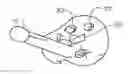 Fig. 01 - SHOULDER ARTHROPLASTY INSTRUMENTATION