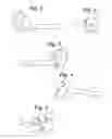 Fig. 02 - SHOULDER ARTHROPLASTY INSTRUMENTATION