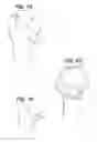 Fig. 08 - SHOULDER ARTHROPLASTY INSTRUMENTATION