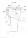 Fig. 09 - Arthroplasty devices and related methods