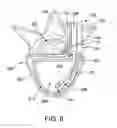 Fig. 07 - Discectomy instrument