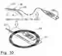 Fig. 11 - Method for placement of neuromonitoring needles