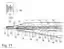 Fig. 18 - Method for placement of neuromonitoring needles