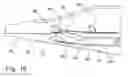 Fig. 20 - Method for placement of neuromonitoring needles