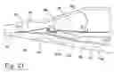 Fig. 22 - Method for placement of neuromonitoring needles