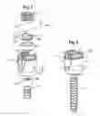 Fig. 06 - Polyaxial bone anchoring device with enlarged pivot angle