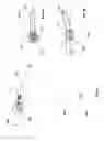 Fig. 08 - Spinal fixation assembly