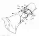 Fig. 01 - Fracture fixation device