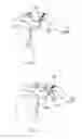 Fig. 04 - Joint repair system