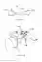 Fig. 07 - Joint repair system