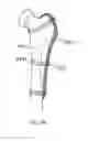 Fig. 30 - Joint repair system