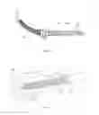 Fig. 02 - Cannulated bone screw and methods of use therefof
