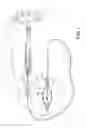 Fig. 02 - Catheters and methods for intracardiac electrical mapping
