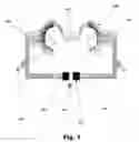 Fig. 02 - SELF-ILLUMINATING CHEEK RETRACTOR