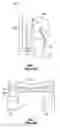 Fig. 02 - Low Profile Orthodontic Bracket