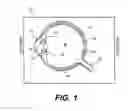 Fig. 02 - Modular intraocular lens designs and methods