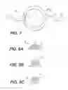 Fig. 06 - Modular intraocular lens designs and methods