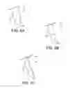 Fig. 06 - Venous valve prostheses