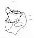 Fig. 01 - HIP REPLACEMENT SYSTEMS AND METHODS