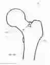 Fig. 09 - HIP REPLACEMENT SYSTEMS AND METHODS